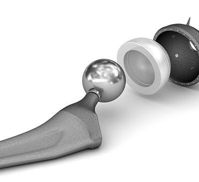 Global Acetabular Prostheses Market 2019-2023